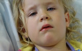 Аденоидный тип лица у детей: признаки и методы лечения